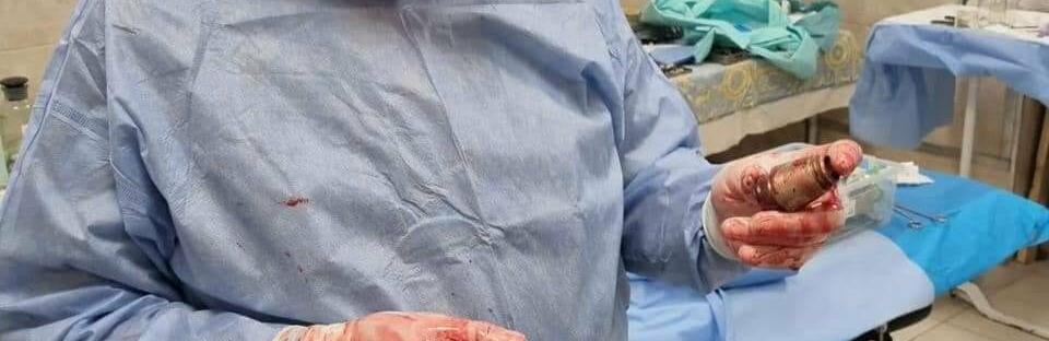 В Україні провели унікальну операцію: видалили з тіла військового гранату